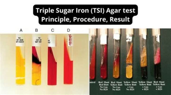 What does a triple screen test for