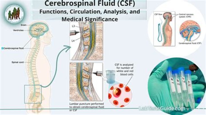 What does blood in cerebrospinal fluid mean