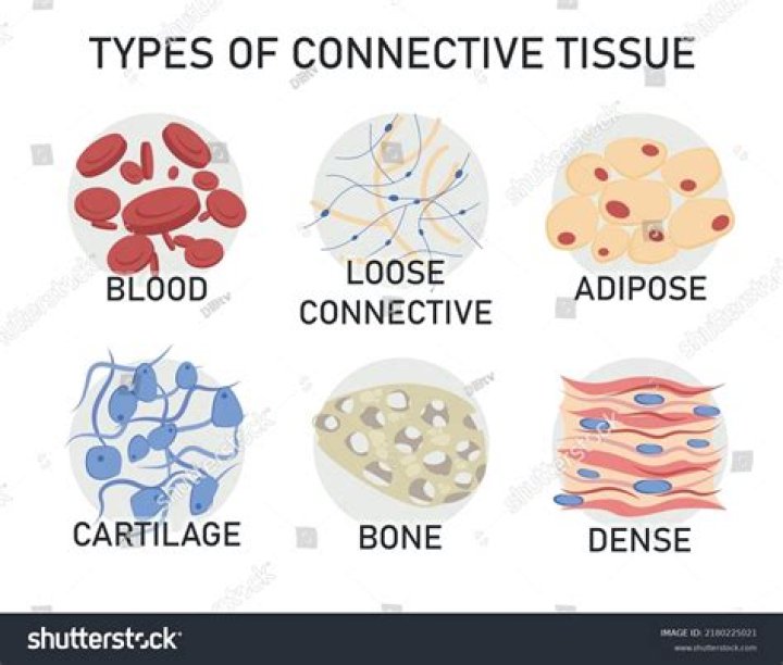 What does connective tissue disease do to your body