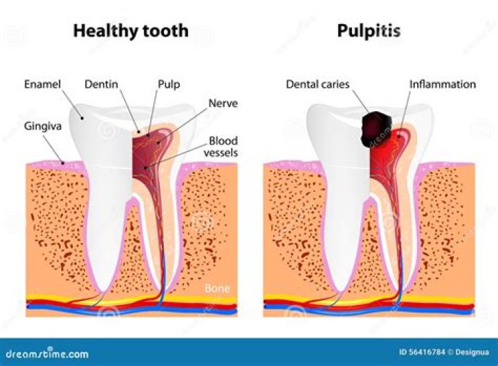 What does dental pulp look like