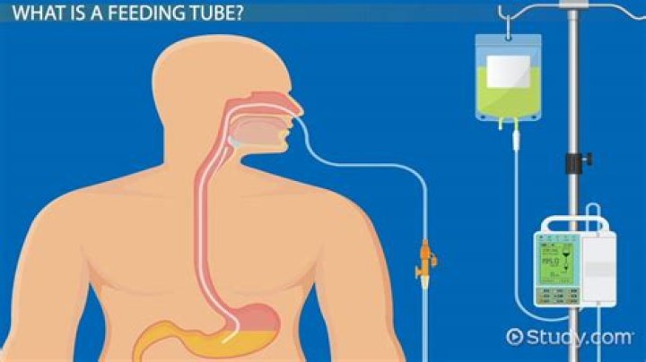 What does enteral tube feeding mean