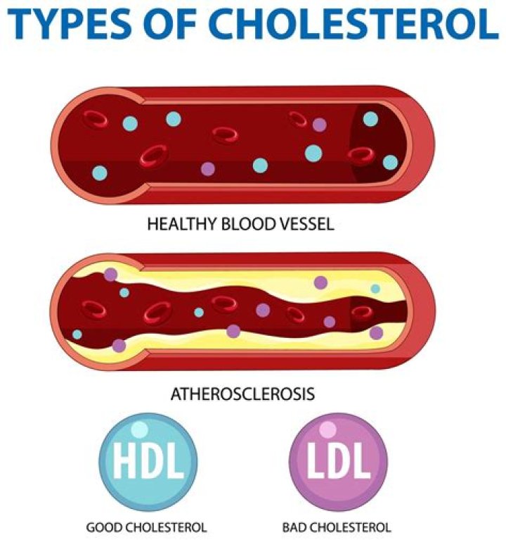 What does it mean if my HDL is low