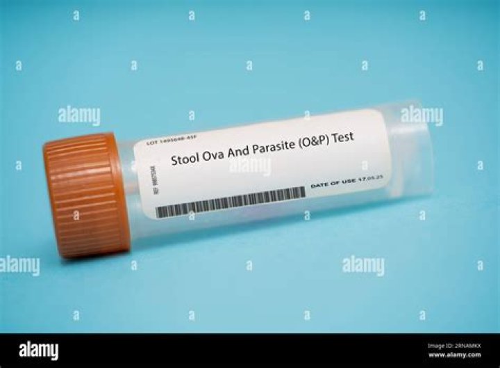 What does ova and parasite test for