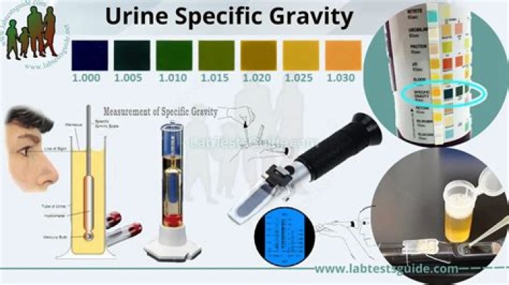 What does specific gravity mean in urine