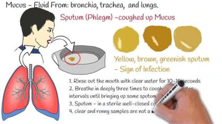What does sputum look like with pneumonia