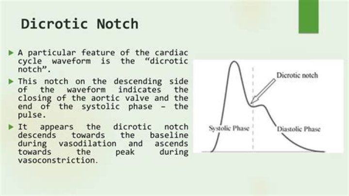 What does the Dicrotic notch on an arterial waveform indicate