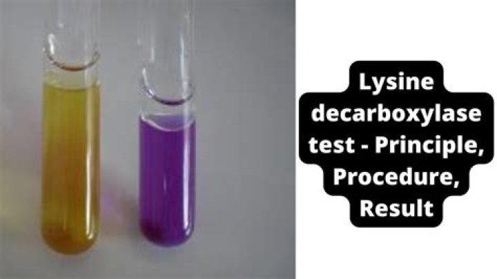 What does the lysine decarboxylation test test for