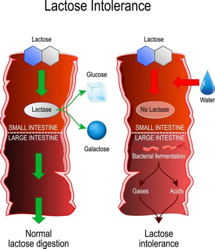 What enzyme is involved in lactose intolerance