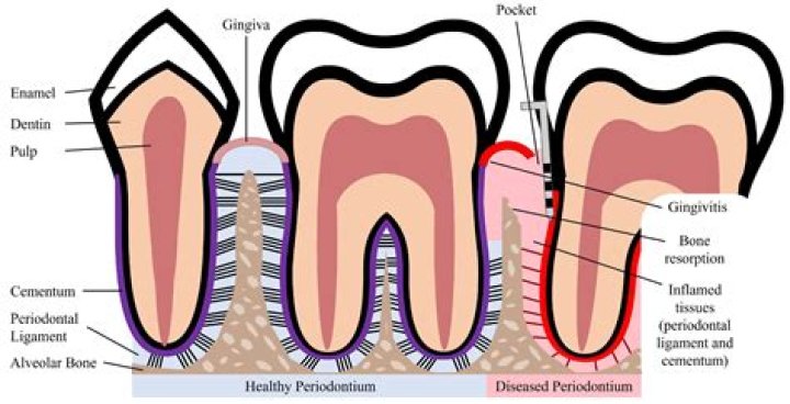 What exactly does a periodontist do