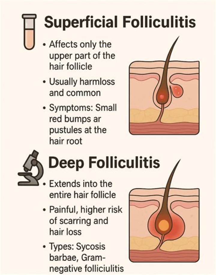 What happens after the follicle ruptures