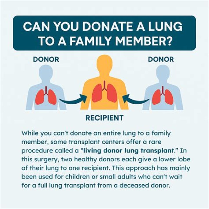 What happens when you donate a lung