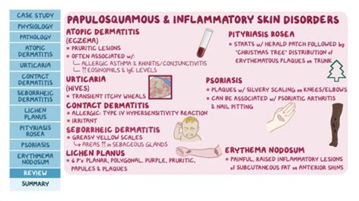 What inflammatory skin disorder is caused by excess sebum
