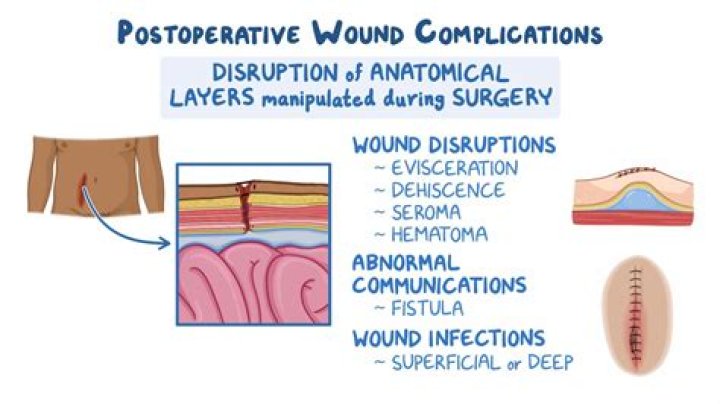What is a complication of skin breakdown