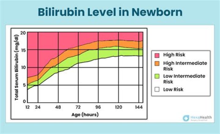 What is a dangerous bilirubin level in newborns