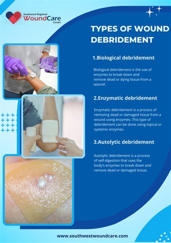 What is a debridement procedure