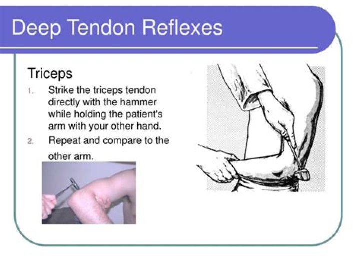What is a deep tendon reflex