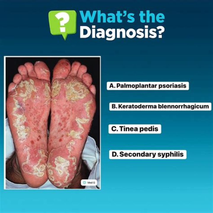 What is a Keratoderma