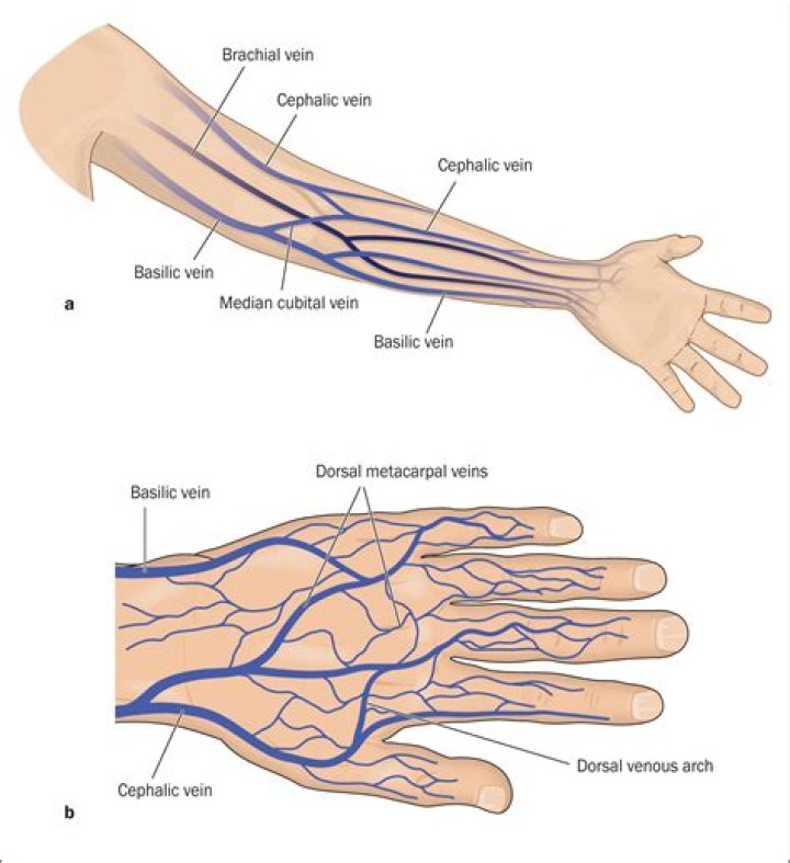 What is a non compressible vein
