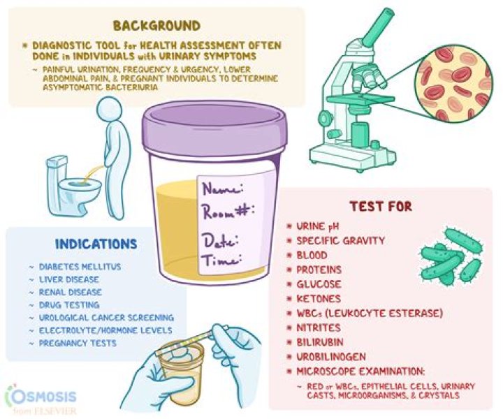 What is a positive urinalysis