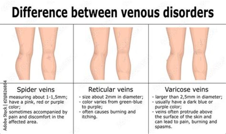 What is a reticular vein