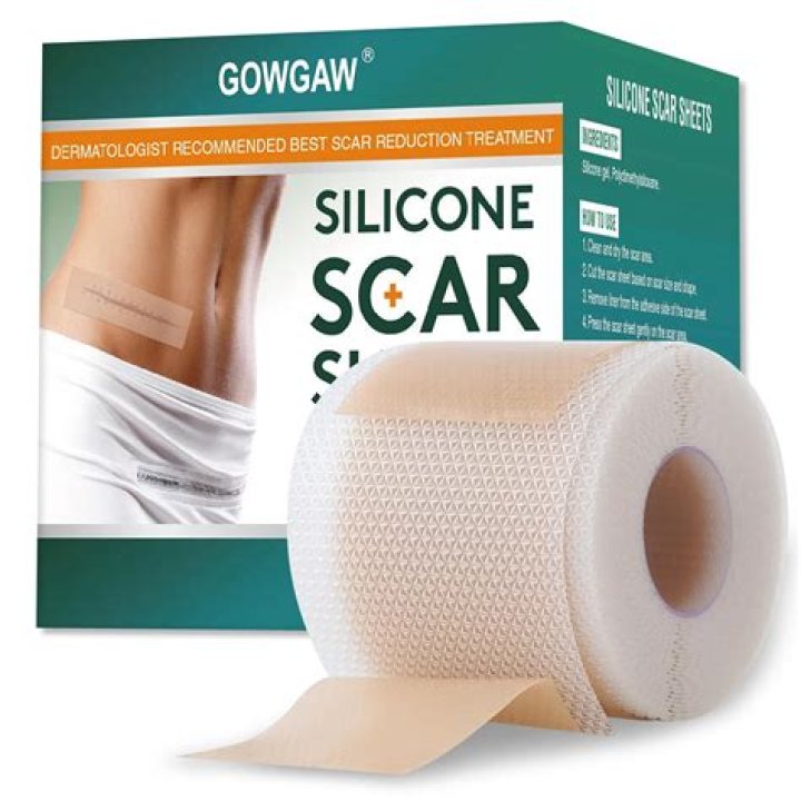 What is a scar report