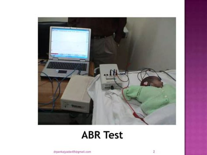 What is an ABR test for adults