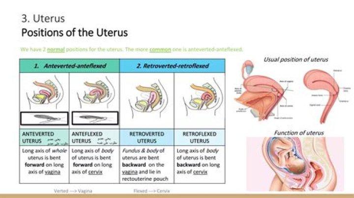 What is an Anteflexed uterus