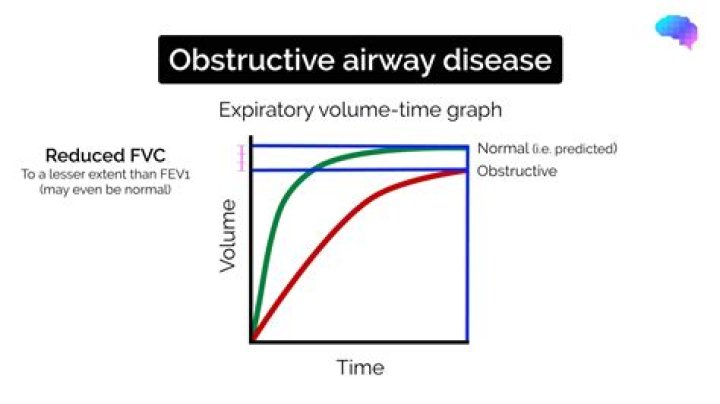 What is an obstructive pattern