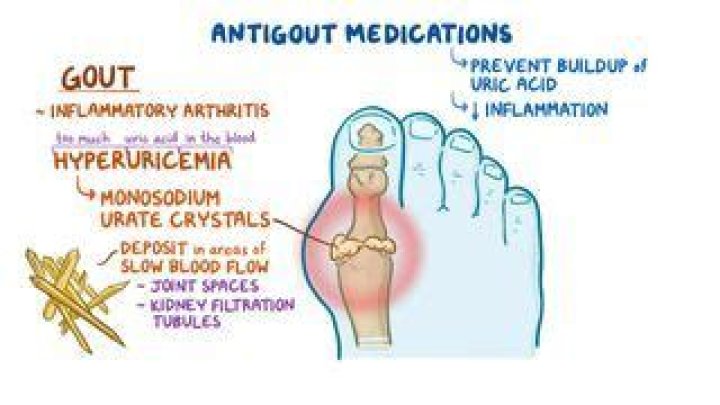 What is anti gout