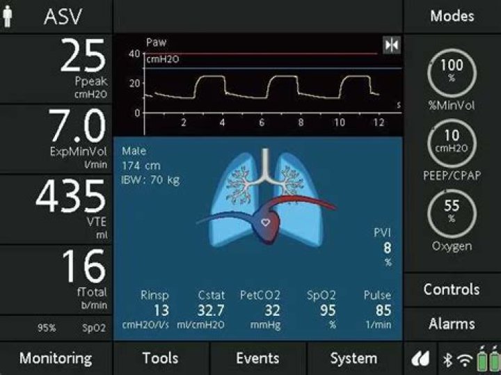 What is ASV mode