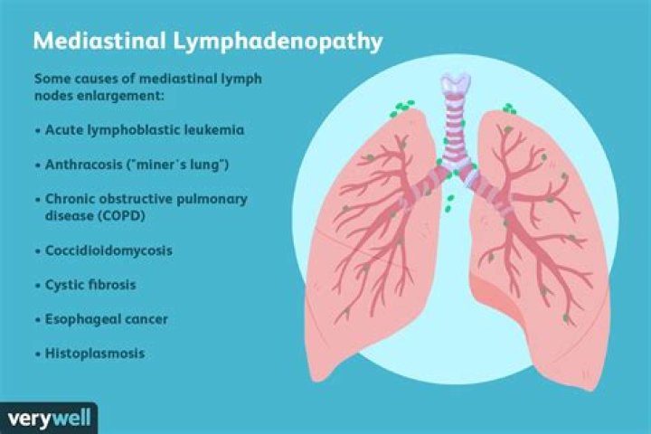 What is axillary lymphadenopathy