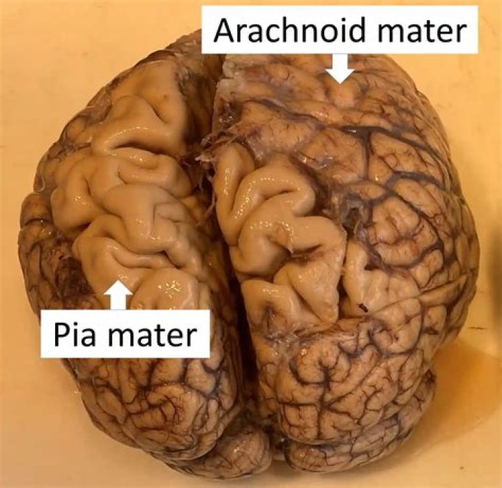 What is between dura mater and arachnoid