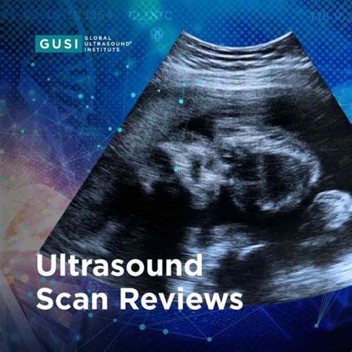 What is C scan ultrasound