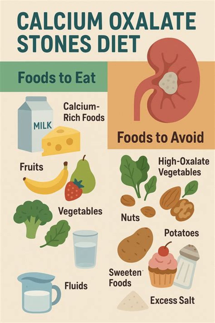 What is calcium oxalate kidney stones