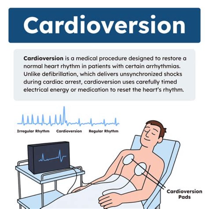 What is cardioversion of atrial fibrillation