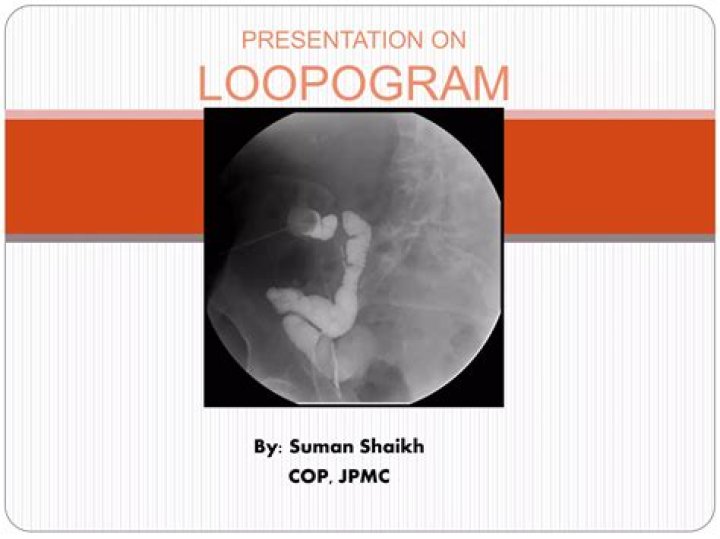What is distal Loopogram