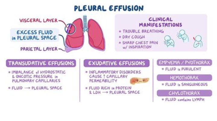 What is effusion and diffusion