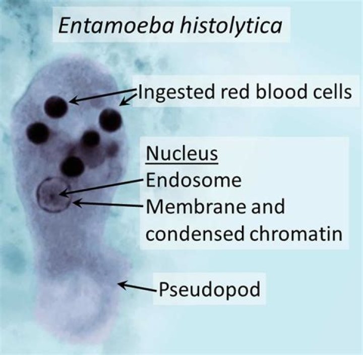 What is invasion of the body by the amoeba Entamoeba histolytica called