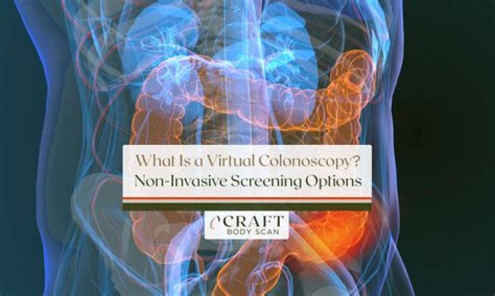 What is involved in a virtual colonoscopy