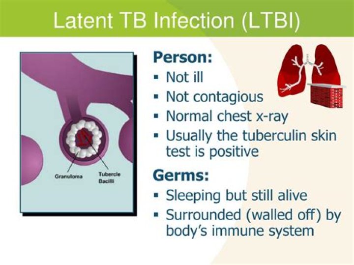 What is latent tuberculosis infection