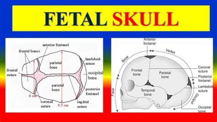 What is molding of the fetal head