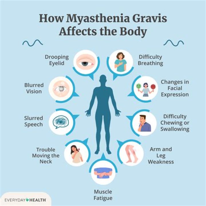 What is myasthenia gravis and what causes it