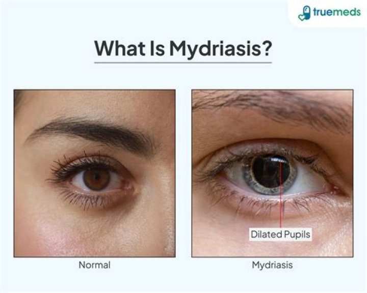 What is mydriasis and miosis