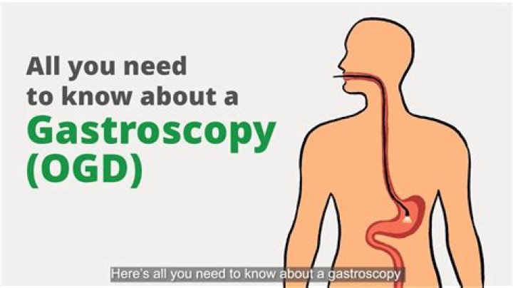 What is OGD procedure
