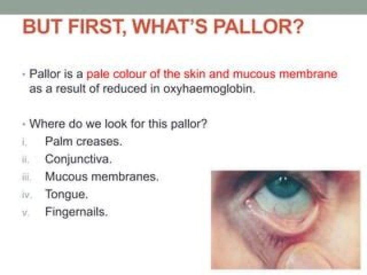 What is pallor medical dictionary
