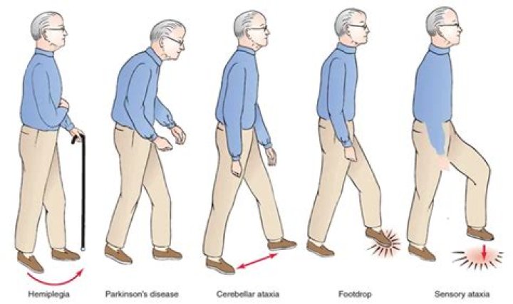 What is Parkinsons gait