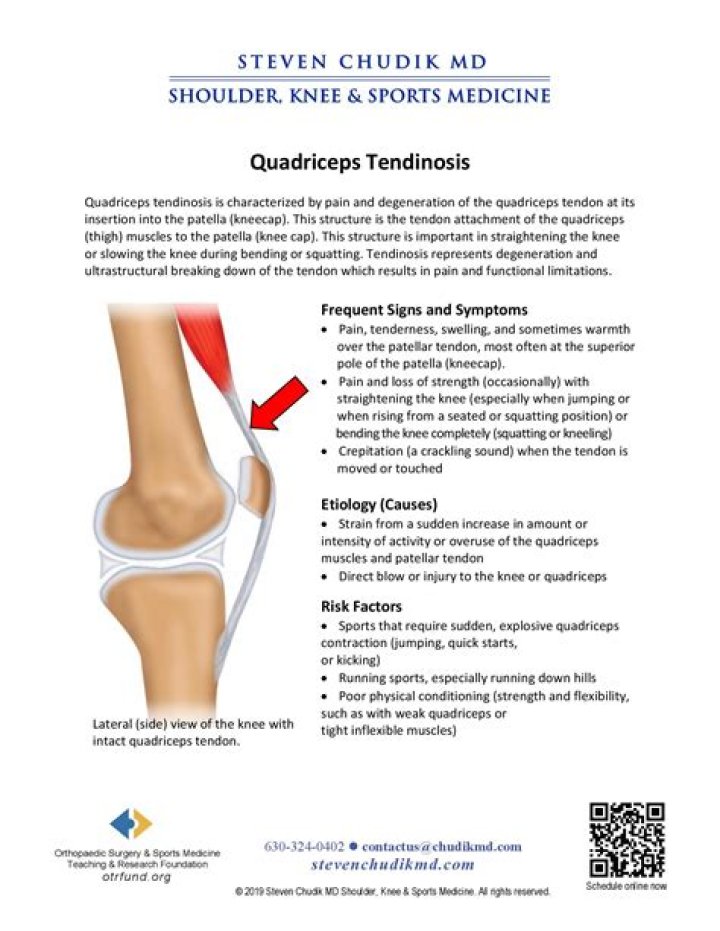 What is quadriceps Enthesopathy