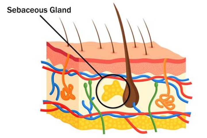 What is sebaceous vulgaris
