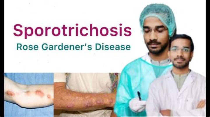 What is sporotrichosis caused by