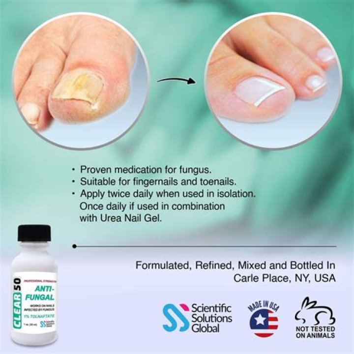 What is the best medication for nail fungus